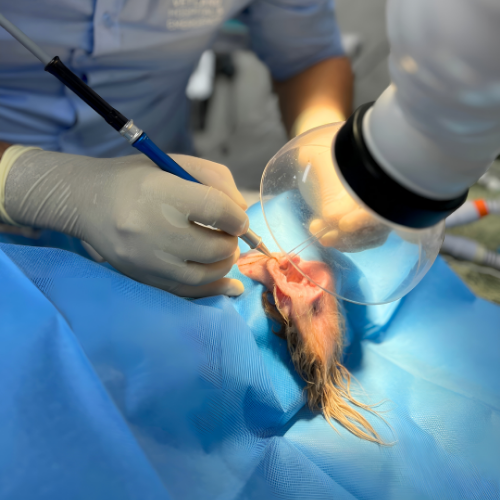 Laser Removal of Polyps