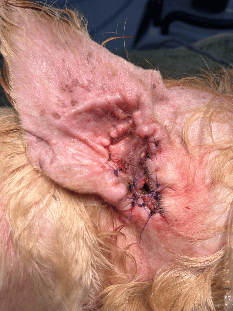 Post Operation Lateral Ear Resection